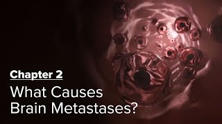 What Causes Brain Metastases? Chapter 2 — Brain Metastases: A Documentary