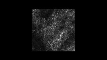 Dendrite activity in brain of awake mouse