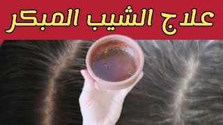 علاج شيب الشعر نهائيا وللابد بدون صبغه /القضاء على الشيب المبكر