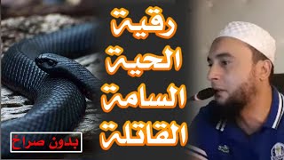 رقية قوية لإبطال مس وحسد الحية السامة سوداء قاتلة ساحرة في الرأس للدم والجراحات (بدون صراخ)