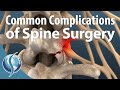 Common Complications of Spine Surgery