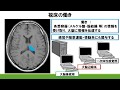 No10 脳画像の診方及び簡単な機能解剖の説明　視床・大脳基底核・内包後脚