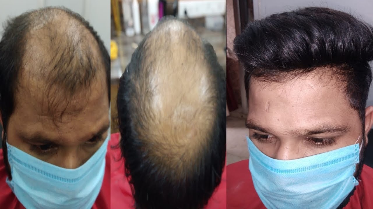 Best Hair bonding hair fixing shop in Nagpur hairbonding hairproblem