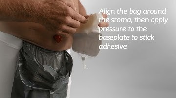 How to use SenSura Mio Uro 1-piece bag