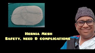 Hernia mesh, its safety, need & its problems