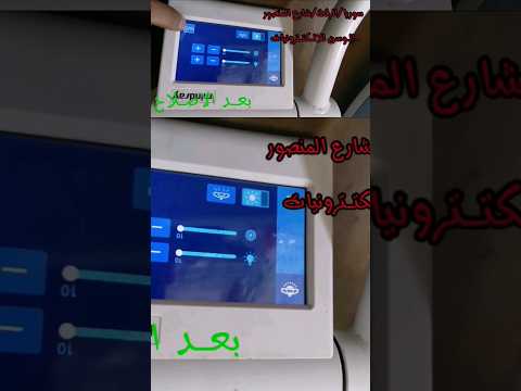 اصلاح كشاف غرفة العمليات اجهزة طبية