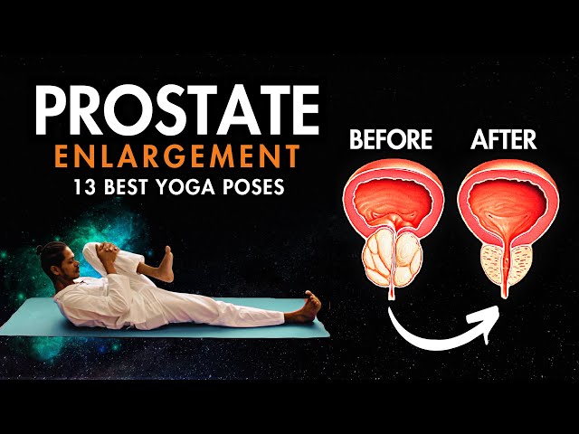 Yoga for Prostate Problems | 13 Best Prostate Yoga Exercises class=