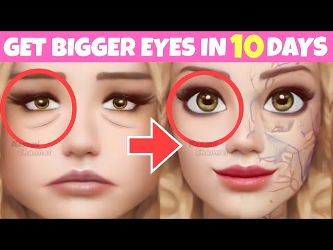 Big Eyes Exercise (Fast Results) | Massage to Lift Droopy Eyelids, Make Your Eyes Symmetrical