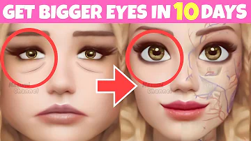 Big Eyes Exercise (Fast Results) | Massage to Lift Droopy Eyelids, Make Your Eyes Symmetrical