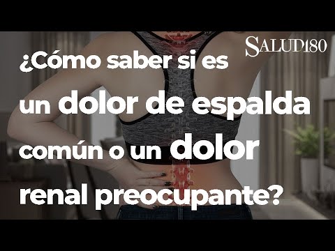 Wideo: Diferencia Entre El Dolor Nerek Y El Dolor De Espalda: Ubicación, Síntoma