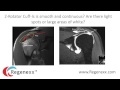 How to read your shoulder MRI with Dr. Centeno of Regenexx
