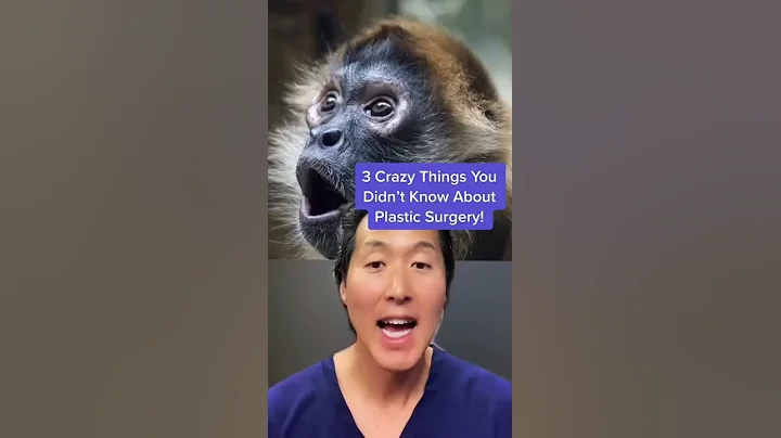 Crazy Things You Didn’t Know About Plastic Surgery! #shorts #plasticsurgery