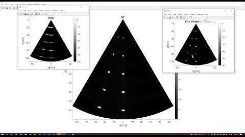 Ultrasound Toolbox – MATLAB toolbox for processing ultrasonic signals