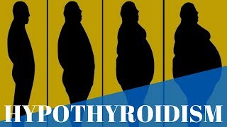 Hypothyroidism:What is it, Causes, Symptoms and Treatments