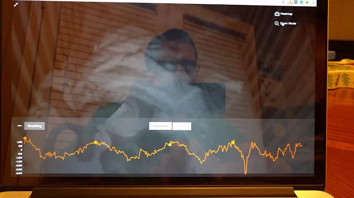 Smartbeat live baby monitoring