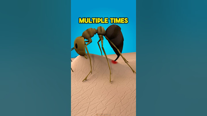 Stay AWAY From Fire Ants 😨 #viral