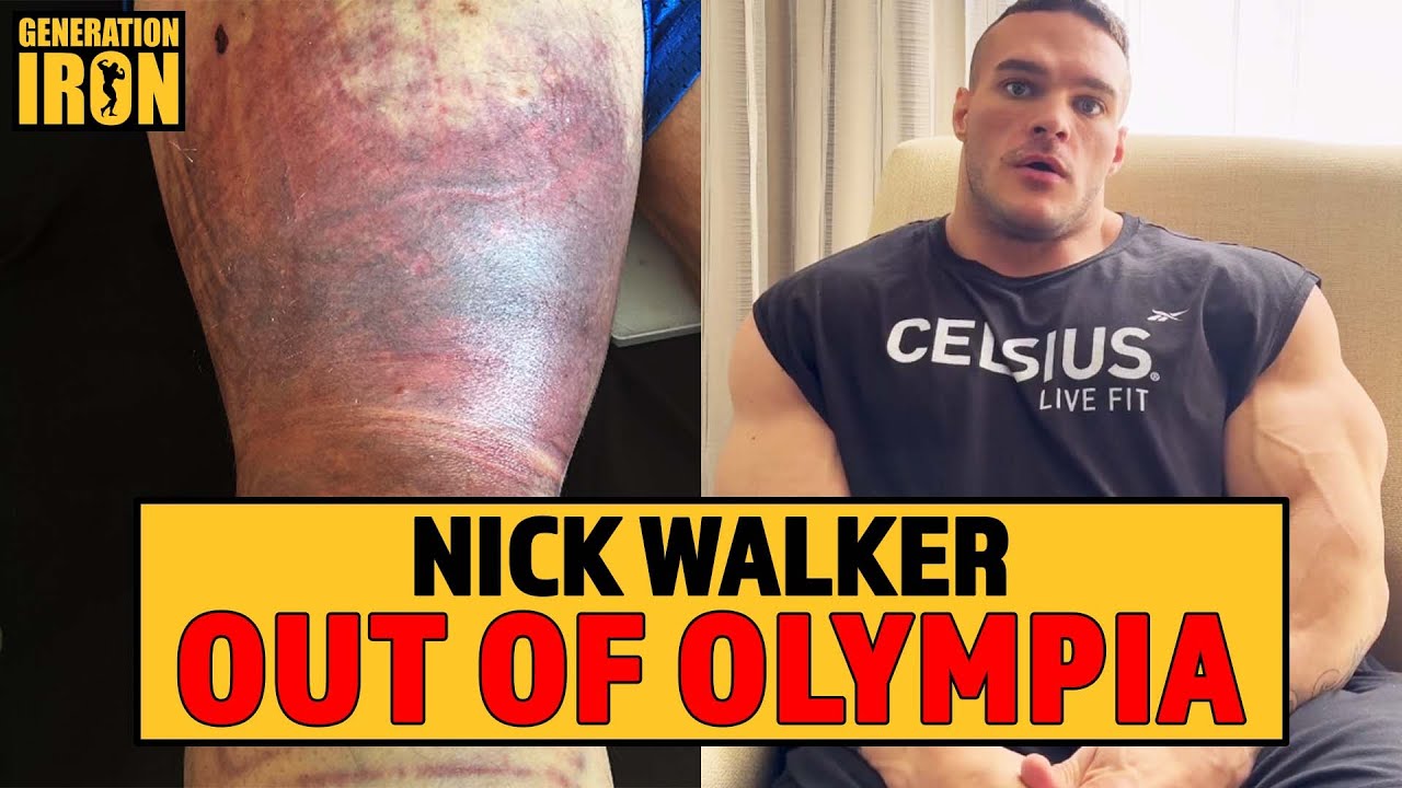 Nick Walker OUT Of 2023 Olympia Due To Torn Hamstring GI News YouTube