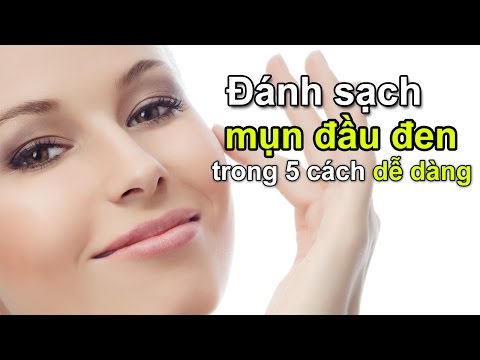 5 cách đánh sạch bóng mụn đầu đen | Bí quyết làm đẹp