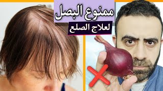 ممنوع استخدام البصل لعلاج الصلع و تساقط الشعر بهذه الطريقة المنتشرة علي يوتيوب