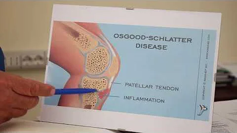 Come curare il morbo di Schlatter?