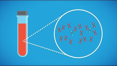 Prenatal screening methods