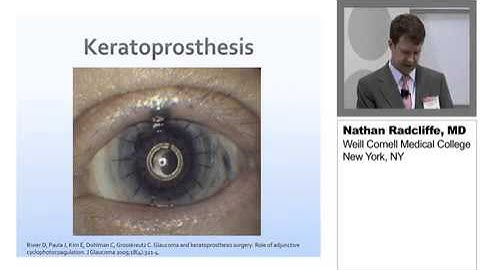Expanding Indications for TSCPC