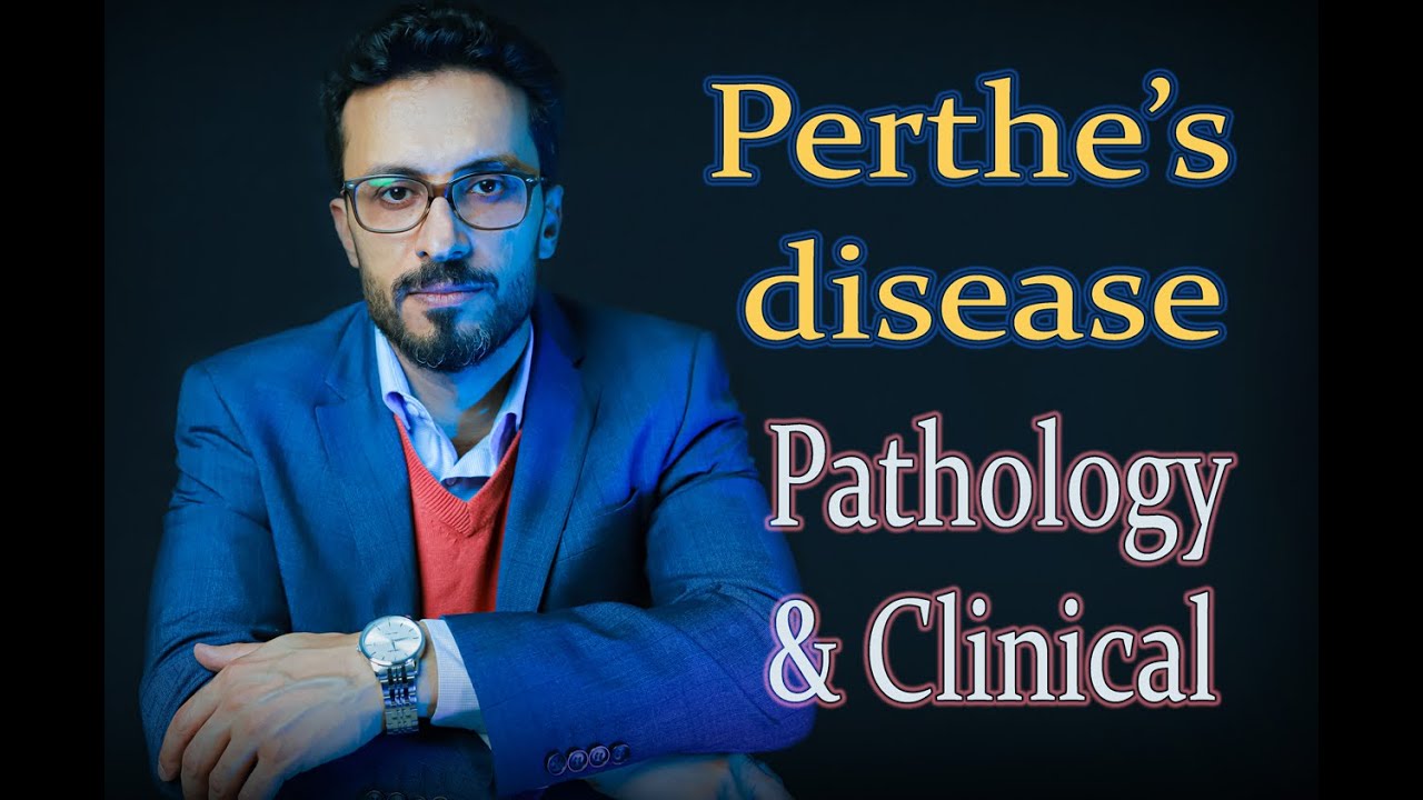 02 Perthe's disease Pathology & Clinical YouTube