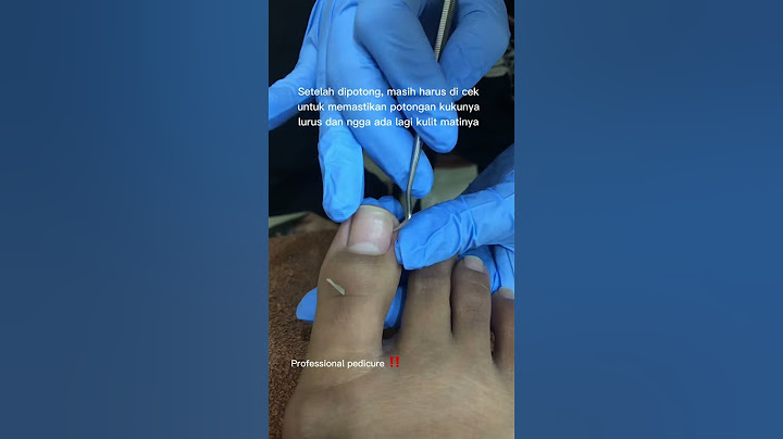 Kuku menusuk/kuku cantengan bikin gak nyaman #menipedi #pedicure #perawatan #salon #kuku 😱