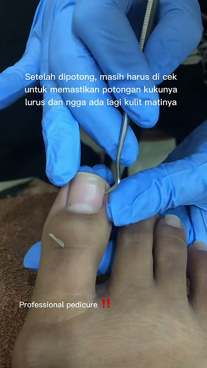 Kuku menusuk/kuku cantengan bikin gak nyaman #menipedi #pedicure #perawatan #salon #kuku 😱