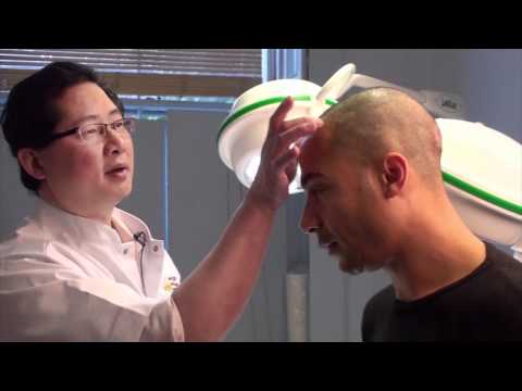 Hair Regrowth Treatment - Stem Cell Hair Restoration Technique