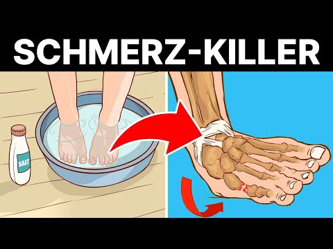 Video: Pfefferminzöl gegen Kopfschmerzen verwenden – wikiHow