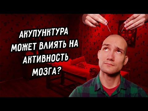 Акупунктура влияет на мозг l Иглоукалывание в психиатрии