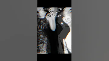 اقوى اغاني راب عن الخيانه اكسبلور لايك متابعه تيك توك ترند تيك توك دويتو ستوريات 