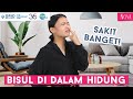 Jerawat di Hidung Bikin Sakit? Hilangkan Sekarang!