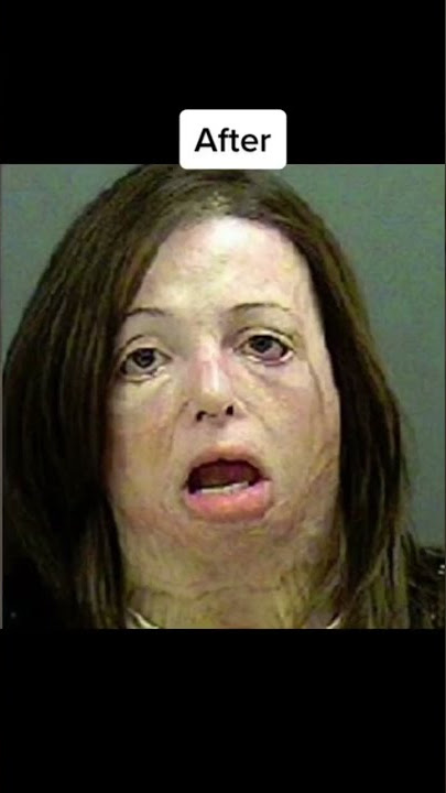 People before and after addiction #shorts