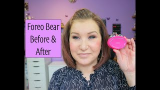 Foreo Bear Micro-Current For Hooded Eyelids - 2 Week Review