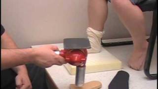 ACOR- Custom Fitting ACOR M.Or.F.S. Foot Orthotics