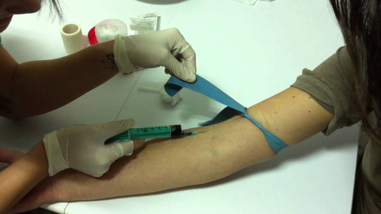 extracción de sangre YouTube extracción de sangre YouTube