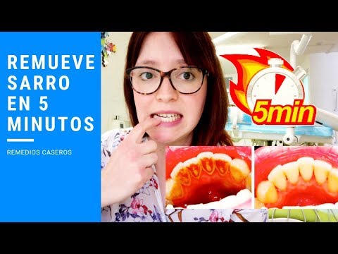 Vídeo: Remedios Populares Para La Salud Dental