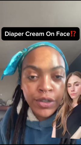 フェイスクリーム Remi.full.run baby skin acne gelcream55g Diaper Cream on Face?! Derm Reacts - YouTube