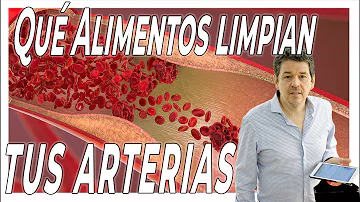 ¿Qué alimentos limpian las arterias?