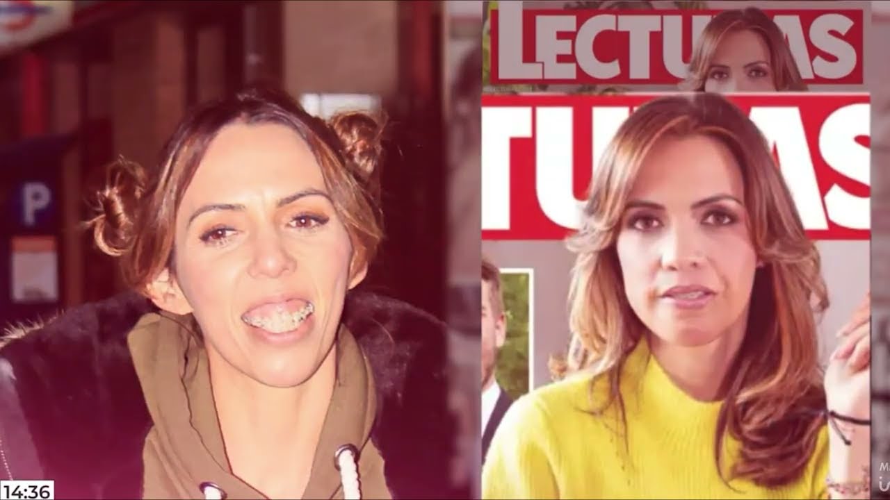 El Dr. Sada explica como fue la intervención que realizó a Paola Olmedo