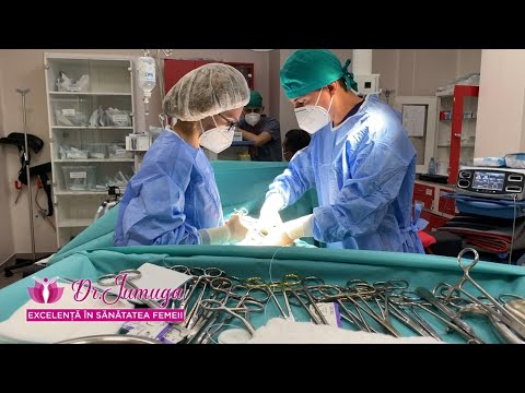 Video: Chirurgie Pentru îndepărtarea Fibroamelor Uterine - Este Necesară Intervenția Chirurgicală? Complicații și Consecințe