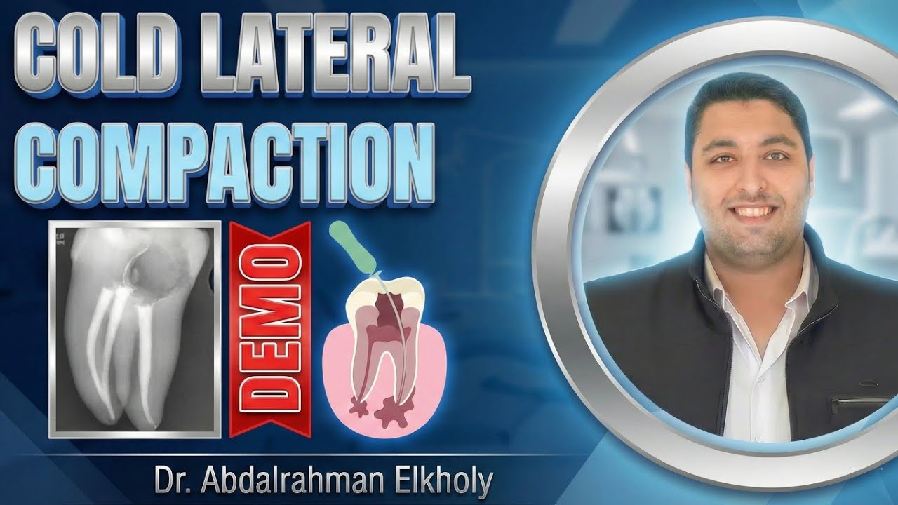 Cold Lateral Compaction demo || Dr. Abdalrahman Elkholy - YouTube