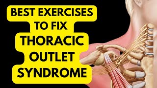 The Game-Changing Approach To Thoracic Outlet Syndrome (you’ve never tried this)