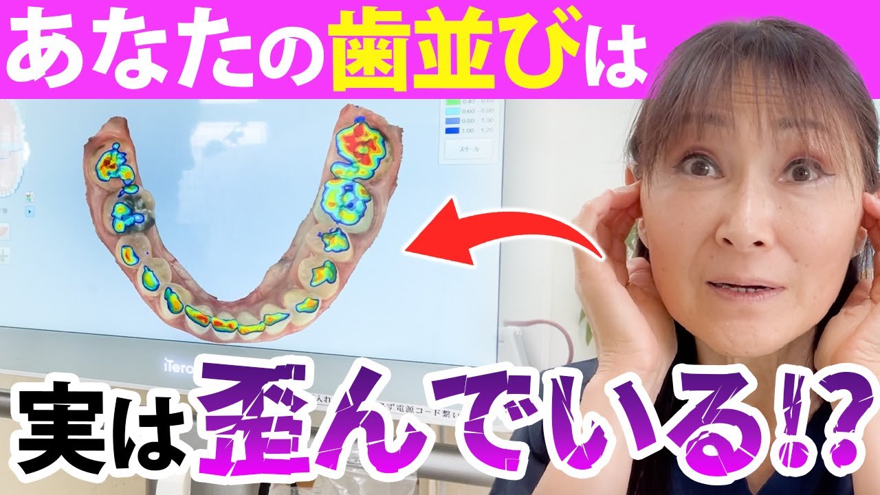 【歯並び】歯列矯正が必要になるかも！？正しい噛み合わせを歯科医が解説！