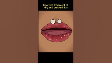 Thumbnail of Dry And Cracked lips