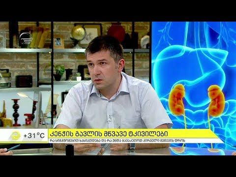 კენჭის გავლის მწვავე ტკივილები  -  რა უნდა გავაკეთოთ  შეტევის დროს