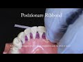 Ribbond periodontal splint technique - Italian text and audio