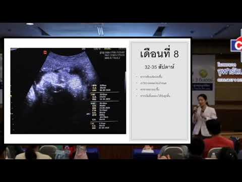 วีดีโอ: การตั้งครรภ์ 35 สัปดาห์ - สิ่งที่คุณต้องรู้